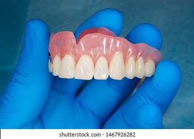 metal partial denture